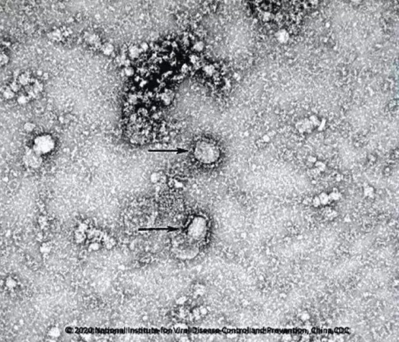 ▲新型冠狀病毒武漢株01。照片來源：國家病原微生物資源庫（中國疾病預(yù)防控制中心病毒病預(yù)防控制所）